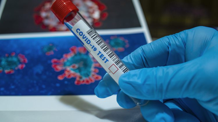 Free COVID-19 tests now available for 18 and older